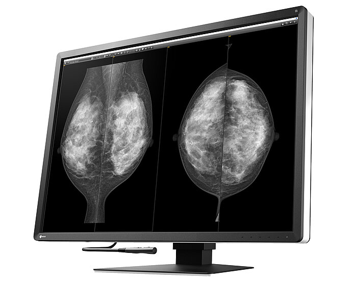 Monitor RX1270 pro digitální mamografii